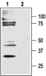 PAR2 Antibody in Western Blot (WB)