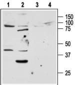 PAR2 Antibody in Western Blot (WB)
