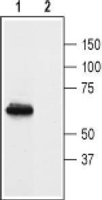 Prokineticin Receptor 1 (extracellular) Antibody in Western Blot (WB)