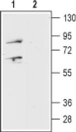 Prokineticin Receptor 1 (extracellular) Antibody in Western Blot (WB)