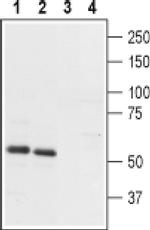 PTH2R (extracellular) Antibody in Western Blot (WB)
