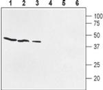 PTGER1 (extracellular) Antibody in Western Blot (WB)