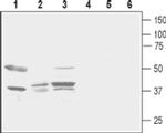 PTGER2 (extracellular) Antibody in Western Blot (WB)