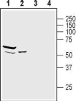 Syntrophin alpha-1 Antibody in Western Blot (WB)
