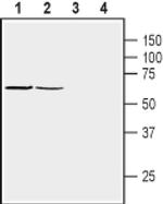SNTB1 Antibody in Western Blot (WB)