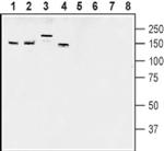 AKAP5 Antibody in Western Blot (WB)