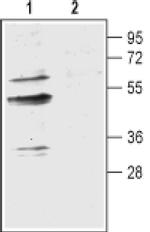 Aquaporin 9 Antibody in Western Blot (WB)