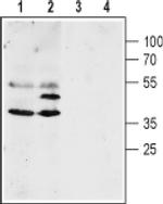 Aquaporin 4 Antibody in Western Blot (WB)