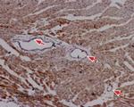 RyR2 Antibody in Immunohistochemistry (Paraffin) (IHC (P))