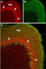 SCN1A Antibody in Immunohistochemistry (IHC)