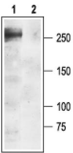 SCN1A Antibody in Western Blot (WB)