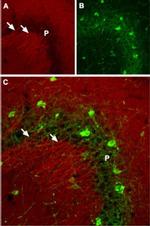SCN2A Antibody in Immunohistochemistry (IHC)