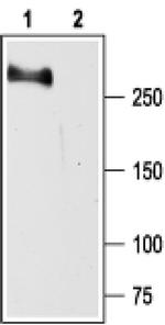 SCN2A Antibody in Western Blot (WB)