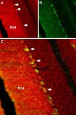 SCN2B Antibody in Immunohistochemistry (IHC)