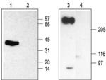 SCN2B Antibody in Western Blot (WB)