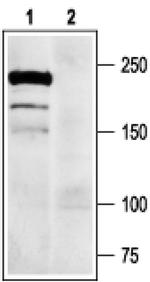 SCN9A Antibody in Western Blot (WB)