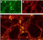 ASIC1 Antibody in Immunohistochemistry (IHC)