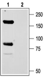 ASIC1 Antibody in Western Blot (WB)