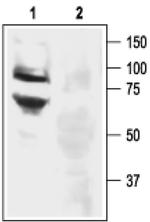 ASIC3 Antibody in Western Blot (WB)