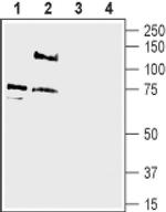pan ASIC (extracellular) Antibody in Western Blot (WB)