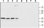 SCN4B (extracellular) Antibody in Western Blot (WB)