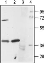 HTR1A Antibody in Western Blot (WB)