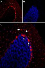 HTR2B (extracellular) Antibody in Immunohistochemistry (IHC)