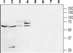 HTR2B (extracellular) Antibody in Western Blot (WB)