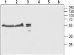 TMEM38B Antibody in Western Blot (WB)