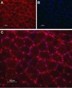 TMEM38A Antibody in Immunohistochemistry (Paraffin) (IHC (P))