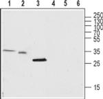 TMEM38A Antibody in Western Blot (WB)