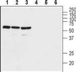 VPAC2 (extracellular) Antibody in Western Blot (WB)