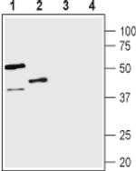 AVPR1B Antibody in Western Blot (WB)