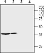 AVPR2 Antibody in Western Blot (WB)