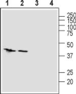 ZIP1 (extracellular) Antibody in Western Blot (WB)