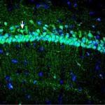 SLC39A3 Antibody in Immunohistochemistry (Frozen) (IHC (F))