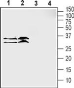 SLC39A3 Antibody in Western Blot (WB)