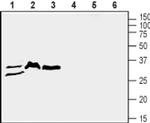SLC39A3 Antibody in Western Blot (WB)