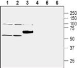 SLC30A1 Antibody in Western Blot (WB)