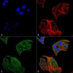 IRGM Antibody in Immunocytochemistry (ICC/IF)