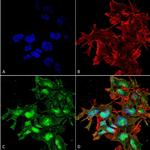 ATG2A Antibody in Immunocytochemistry (ICC/IF)