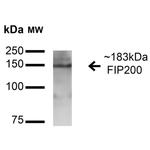 FIP200 Antibody in Western Blot (WB)