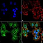 ULK2 Antibody in Immunocytochemistry (ICC/IF)