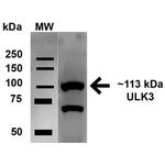 ULK2 Antibody in Western Blot (WB)