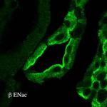 SCNN1B Polyclonal Antibody