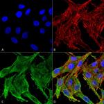 Kir4.1 (KCNJ10) Polyclonal Antibody
