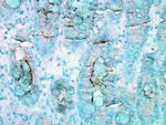 HSC70 Antibody in Immunohistochemistry (IHC)