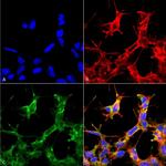 Acetyl-HSP70 (Lys77) Antibody in Immunocytochemistry (ICC/IF)