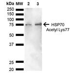 Acetyl-HSP70 (Lys77) Antibody in Western Blot (WB)
