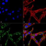 HSF2 Antibody in Immunocytochemistry (ICC/IF)